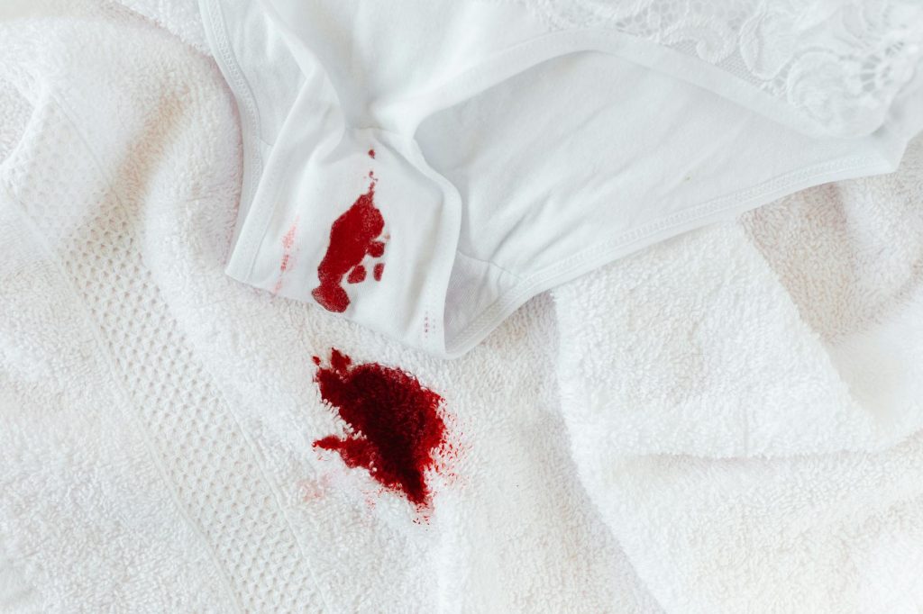 Close-up of menstrual blood stain on white underwear and towel, symbolizing period awareness.