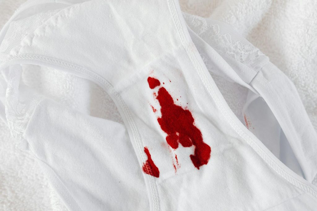 Close-up of white panties with red menstrual blood stain on white background.