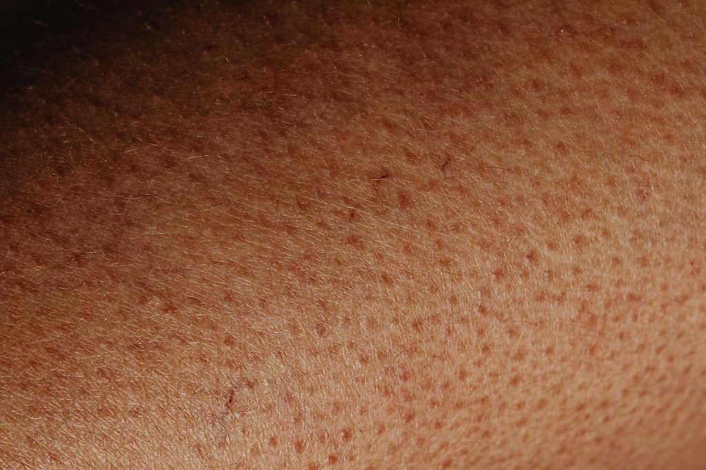 Detailed close-up view of human skin surface showing natural texture and imperfections.